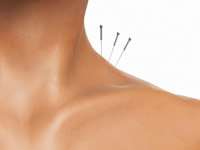 Crescer Fisioterapia e Acupuntura foto 1